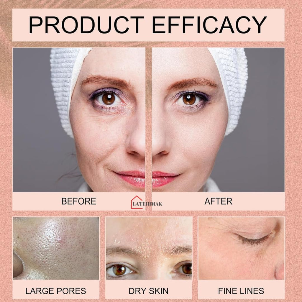 Lacto Calamine Face Sheet Masks | Combo Pack | Vitamin C, Hyaluronic Acid & Green Tea Face Sheet Masks | Brightening, Hydrating & Clarifiying | 150ml (Pack of, 6)