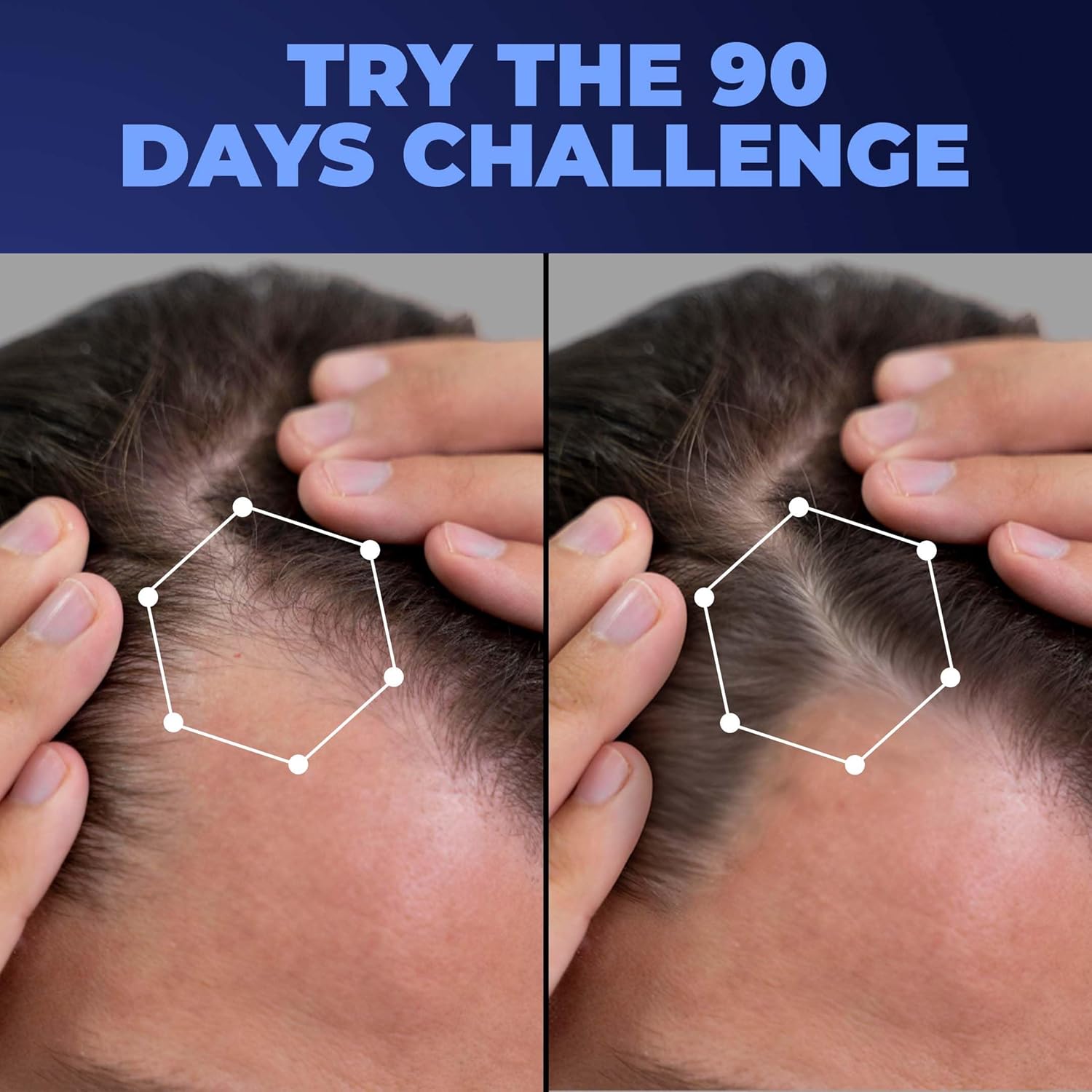 VEGA X-Star Hair Straightening Brush for Women with Thermo Protect Technology & Anti Scald Technology, 16 Temperature Settings, Hair Straightener Brush, (VHSB-03), Black