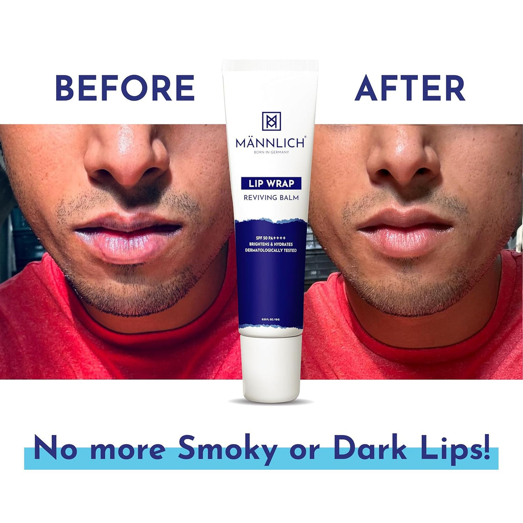 SebaMed Lip Defense Lip Balm With Spf 30 + Vit E | Regenerates Dry, Chapped Lips | Intensive Care With Vit E, Jojoba Oil & Chamomile |Clinically Tested | For Men & Women, 4.8 Gm, White